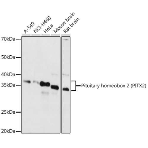 Pituitary homeobox 2 (PITX2) Rabbit pAb