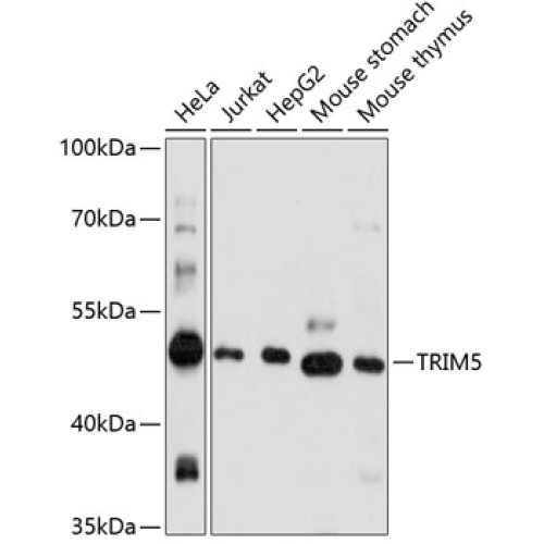 TRIM5 Rabbit pAb