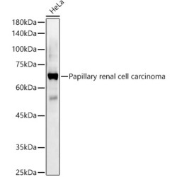 Papillary renal cell carcinoma Rabbit pAb