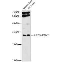 [KO Validated] SLC25A4/ANT1 Rabbit pAb