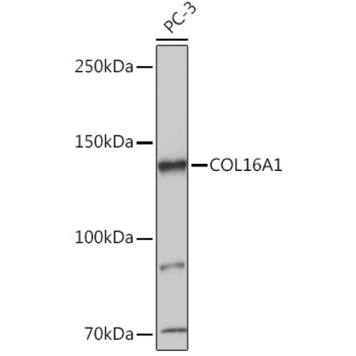 COL16A1 Rabbit pAb