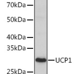 UCP1 Rabbit pAb