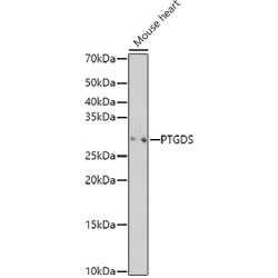 PTGDS Rabbit pAb