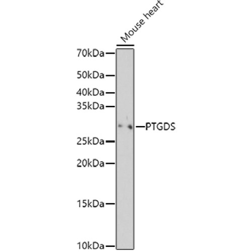 PTGDS Rabbit pAb