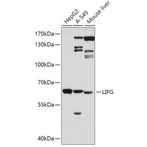 LIPG Rabbit pAb
