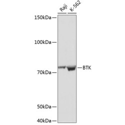 BTK Rabbit mAb