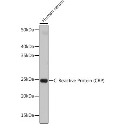 C-Reactive Protein (CRP) Rabbit mAb