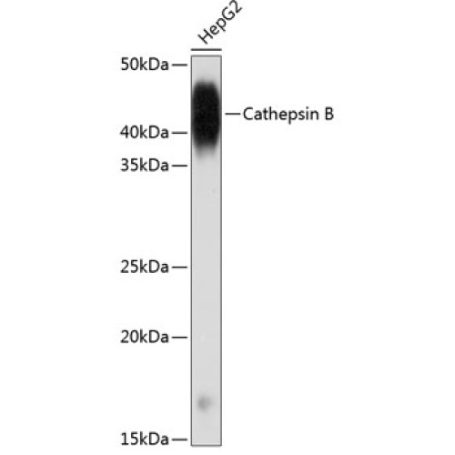 Cathepsin B Rabbit mAb