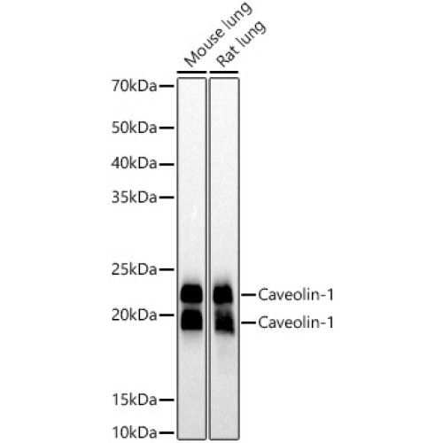 [KO Validated] Caveolin-1 Rabbit mAb