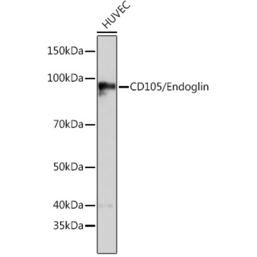 CD105/Endoglin Rabbit mAb