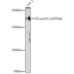 CD11a/LFA-1A/ITGAL Rabbit mAb