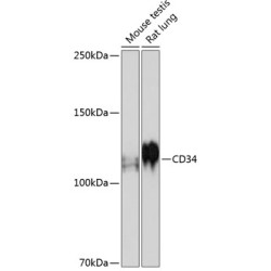 CD34 Rabbit mAb