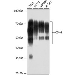 CD46 Rabbit mAb