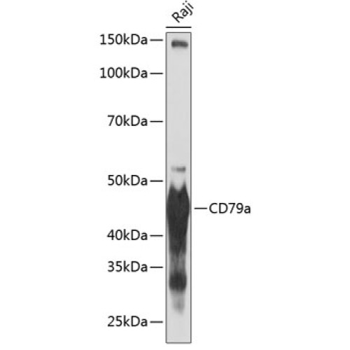 CD79a Rabbit mAb