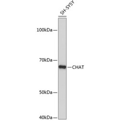 ChAT Rabbit mAb