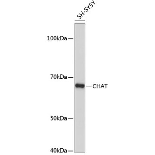 ChAT Rabbit mAb