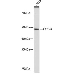 CXCR4 Rabbit mAb