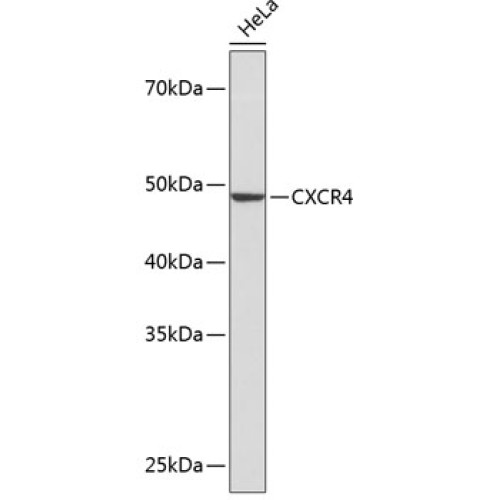 CXCR4 Rabbit mAb