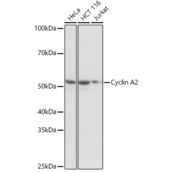 Cyclin A2 Rabbit mAb