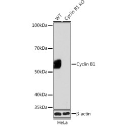 [KO Validated] Cyclin B1 Rabbit mAb