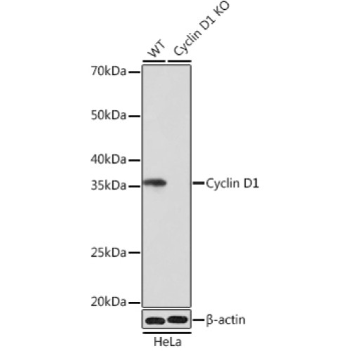 [KO Validated] Cyclin D1 Rabbit mAb