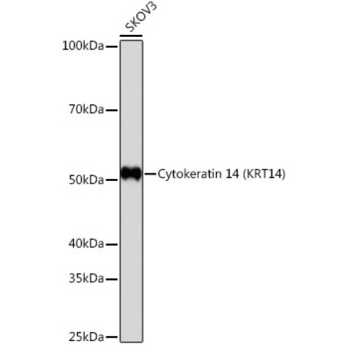 Cytokeratin 14 (KRT14) Rabbit mAb