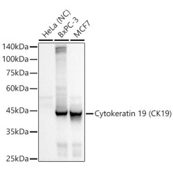 Cytokeratin 19 (CK19) Rabbit mAb