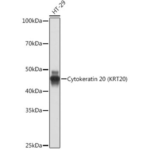 Cytokeratin 20 (CK20) Rabbit mAb