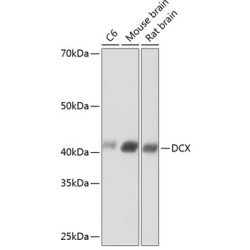 Doublecortin Rabbit mAb