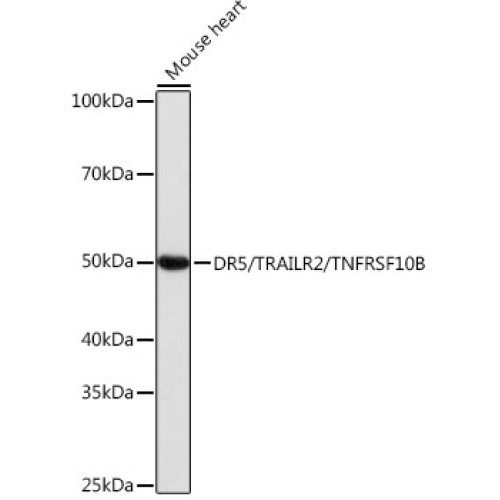 DR5/TRAILR2/TNFRSF10B Rabbit mAb