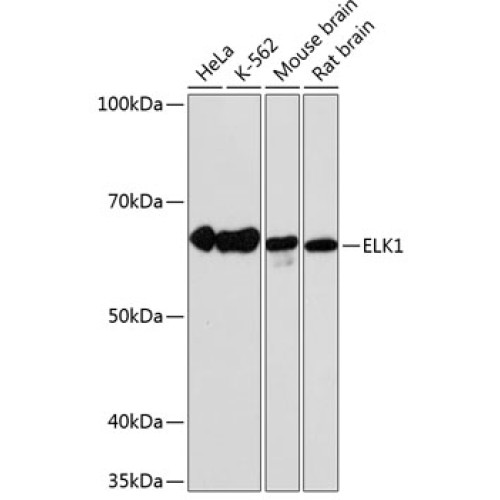 ELK1 Rabbit mAb