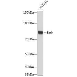 Ezrin Rabbit mAb