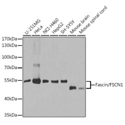 [KO Validated] Fascin/FSCN1 Rabbit pAb