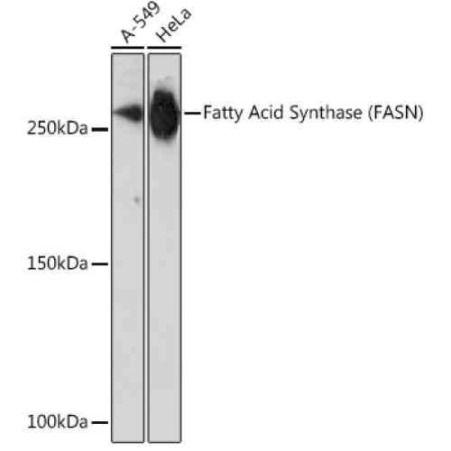 Fatty Acid Synthase (FASN) Rabbit mAb