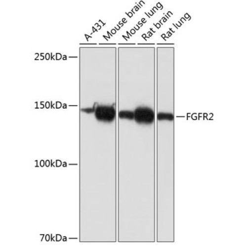 [KO Validated] FGFR2 Rabbit mAb