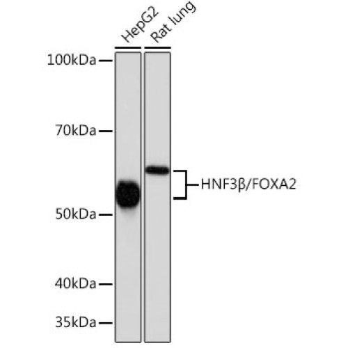 HNF3β/FOXA2 Rabbit mAb