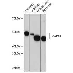 GAP43 Rabbit mAb