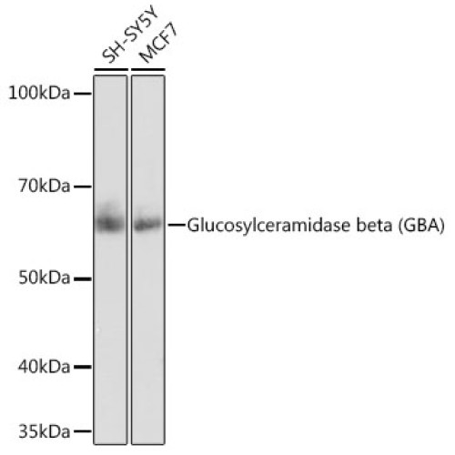 Glucosylceramidase beta (GBA) Rabbit mAb
