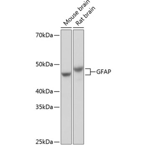 GFAP Rabbit mAb