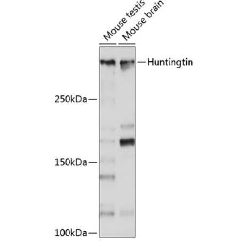 [KO Validated] Huntingtin Rabbit mAb