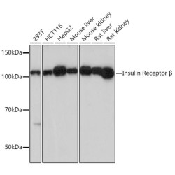 Insulin Receptor Rabbit mAb