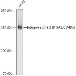 [KO Validated] Integrin alpha 2 (ITGA2/CD49b) Rabbit mAb