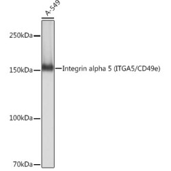 Integrin alpha 5 (ITGA5/CD49e) Rabbit mAb