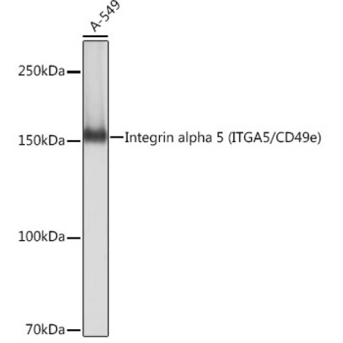 Integrin alpha 5 (ITGA5/CD49e) Rabbit mAb