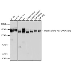 Integrin alpha V (ITGAV/CD51) Rabbit mAb