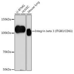 Integrin beta 3 (ITGB3/CD61) Rabbit mAb