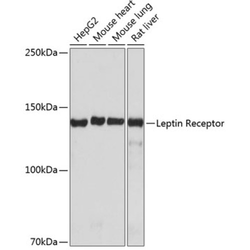 Leptin Receptor Rabbit mAb