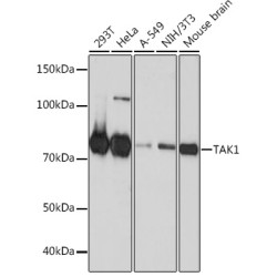 [KO Validated] TAK1 Rabbit mAb