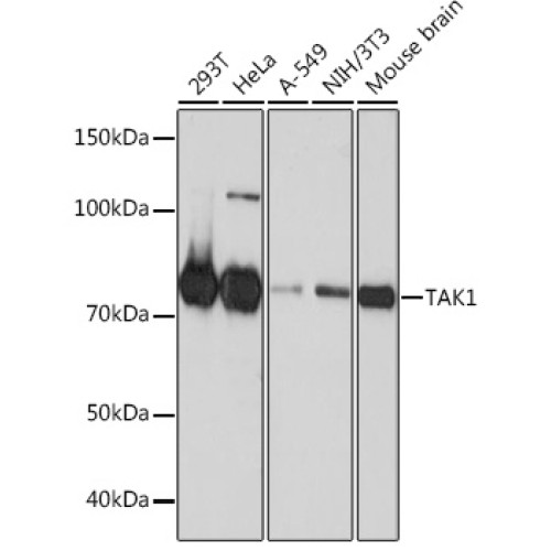 [KO Validated] TAK1 Rabbit mAb