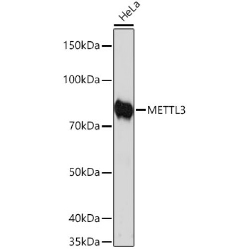 [KD Validated] METTL3 Rabbit mAb